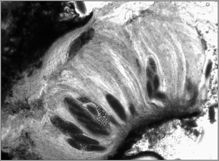 Pertusaria hymenea, microscope image