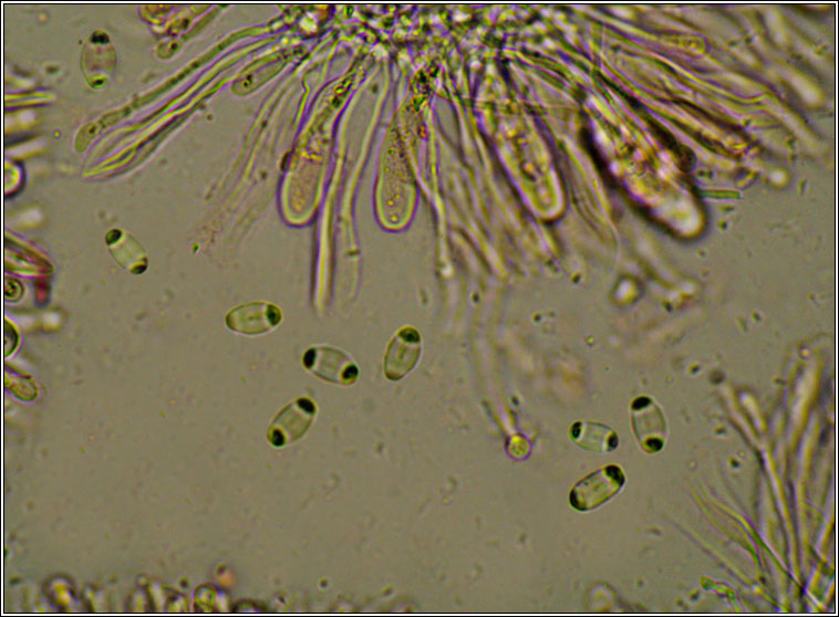 Xanthoria polycarpa, microscope photograph