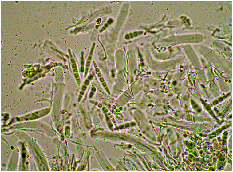 Enterographa crassa, ascus and spores