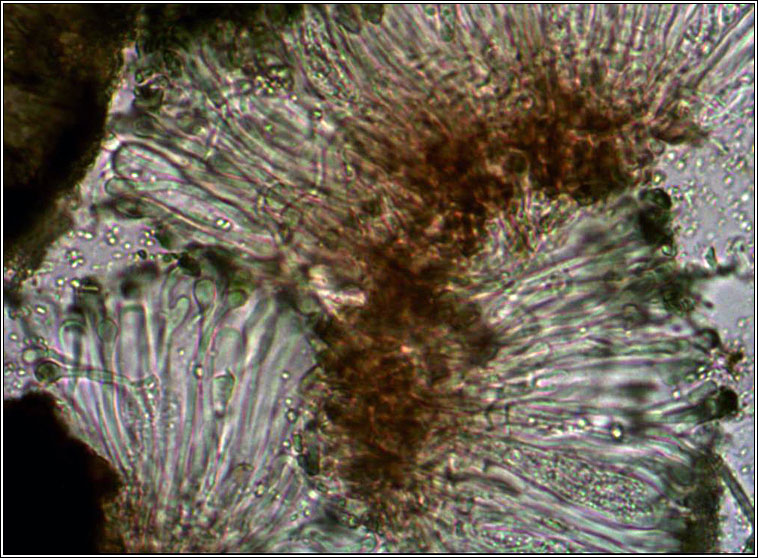 Toninia aromatica, microscope photo