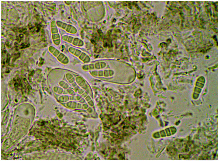Arthonia radiata, microscope photo