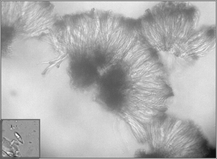 Toninia sedifolia, microscope photo