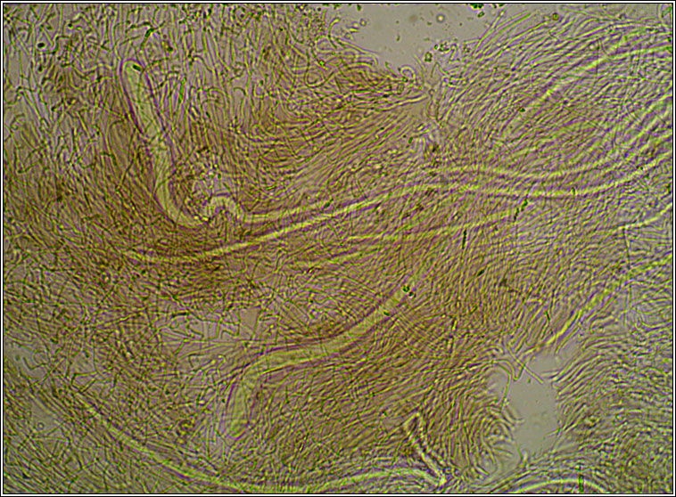 Gomphillus calycioides, ascus