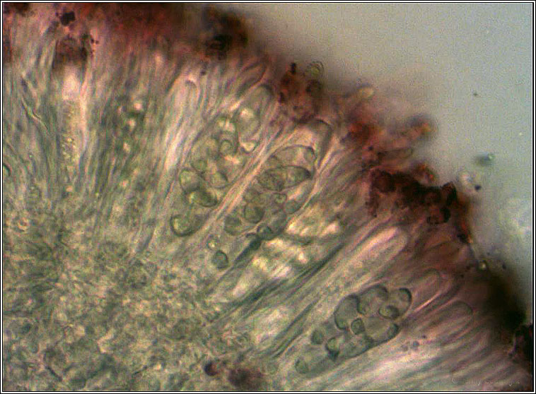 Caloplaca cerina, microscope photograph