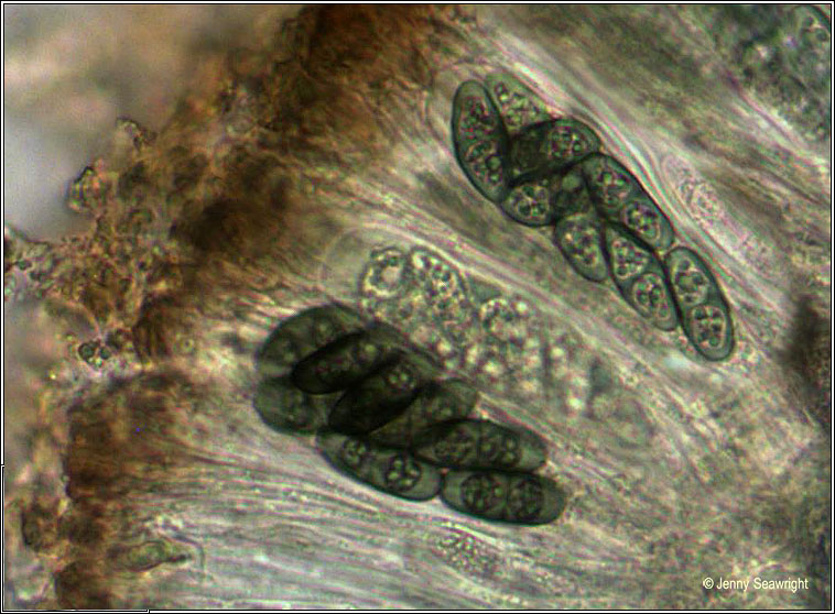 Physcia aipolia, microscope image