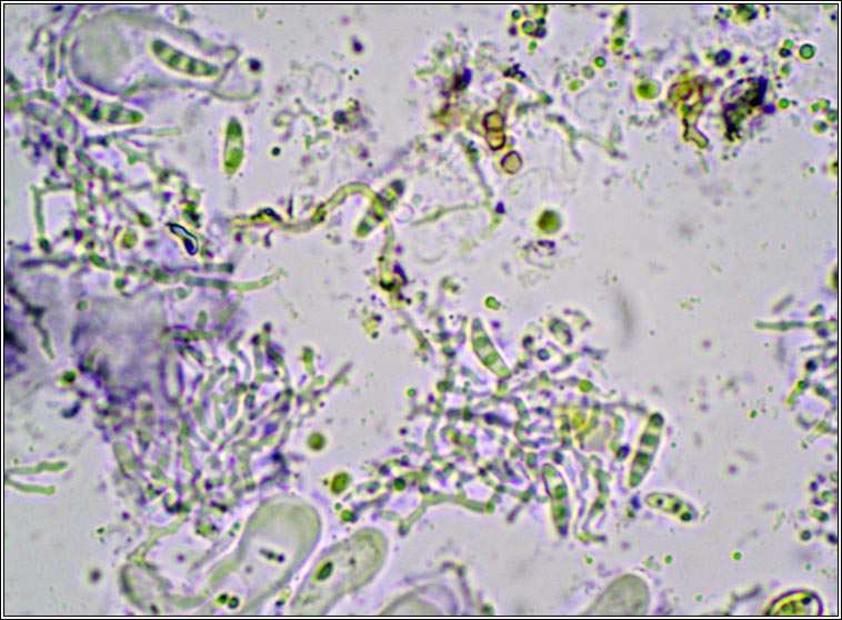 Micarea nitschkeana