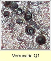 Verrucaria Q1