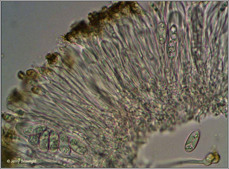 Xanthoria parietina, microscope image