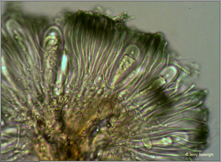 Lecidella elaeochroma, microscope image