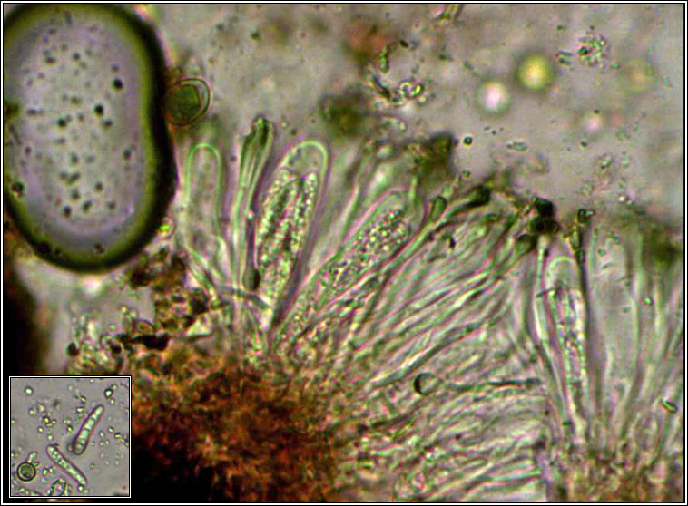 Toninia aromatica, microscope photo