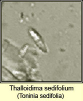 Toninia sedifolia, microscope image