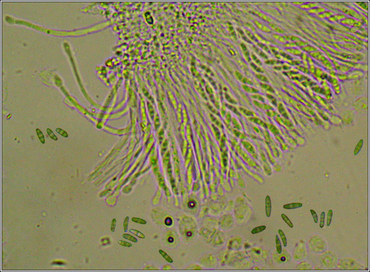 Dimerella lutea, microscope photograph