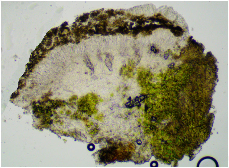 Lecanora carpinea