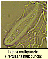 Pertusaria multipuncta ascus and spores