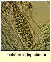 Thelotrema lepadinum, microscope image