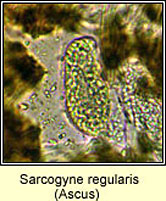 Sarcogyne regularis, ascus