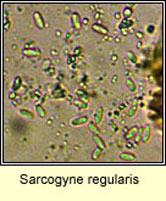 Sarcogyne regularis, spores