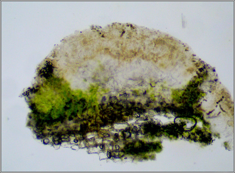 Lecanora hagenii