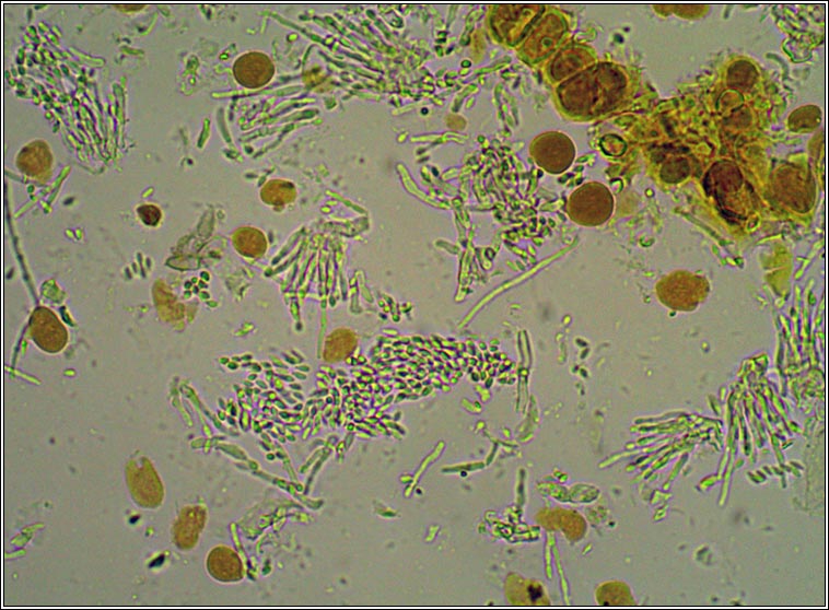 Ephebe hispidula, conidia