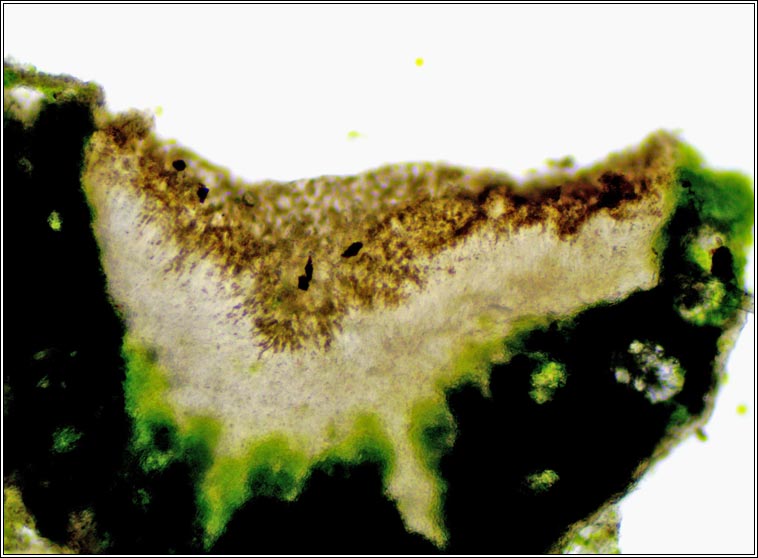 Lecanora intumescens