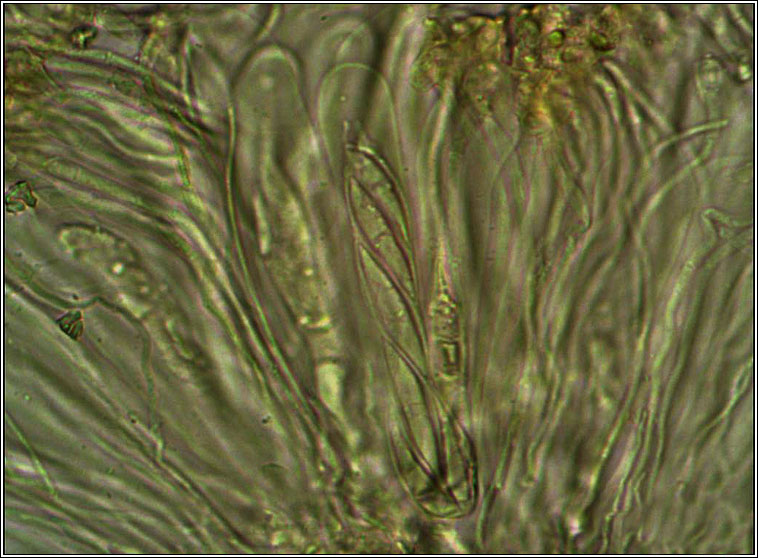 Lobaria virens, ascus, microscope photos