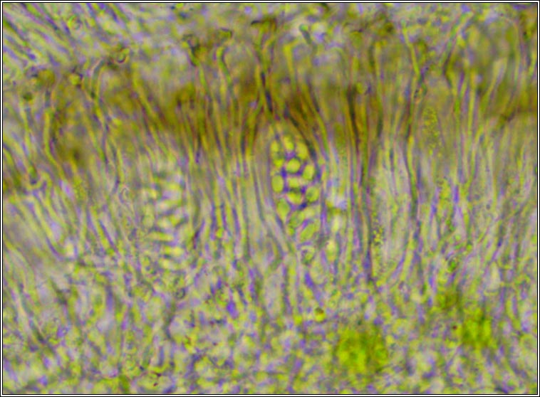 Myriolecis sambuci, Lecanora sambuci