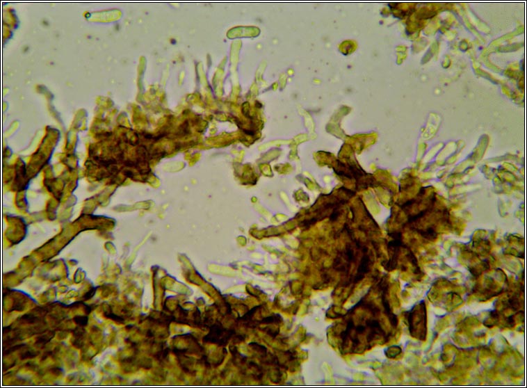 Lichenodiplis poeltii