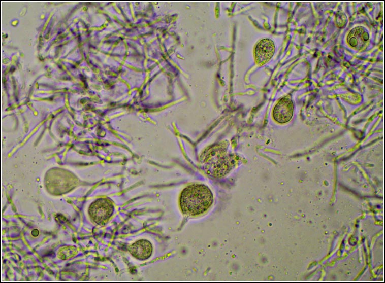 Tremella pertusariae