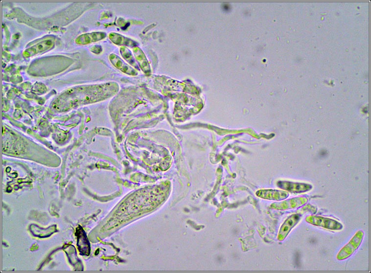 Lichenopeltella pannariacearum