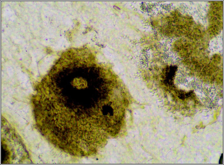 Abrothallus suecicus (anamorph)