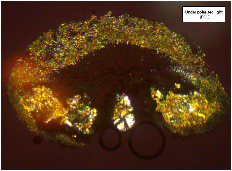 Lecanora pseudargentata